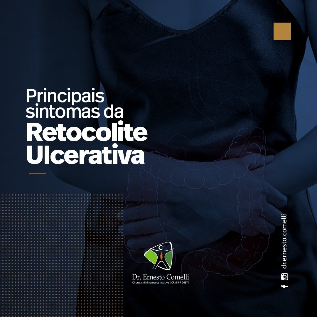 Principais Sintomas Da Retocolite Ulcerativa Dr Ernesto Comelli