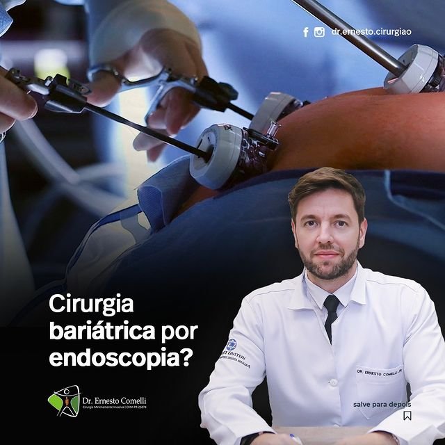 Cirurgia Bari Trica Por Endoscopia Dr Ernesto Comelli