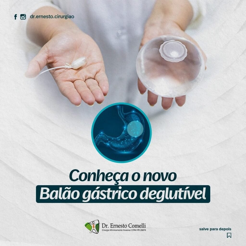 balão gástrico deglutível