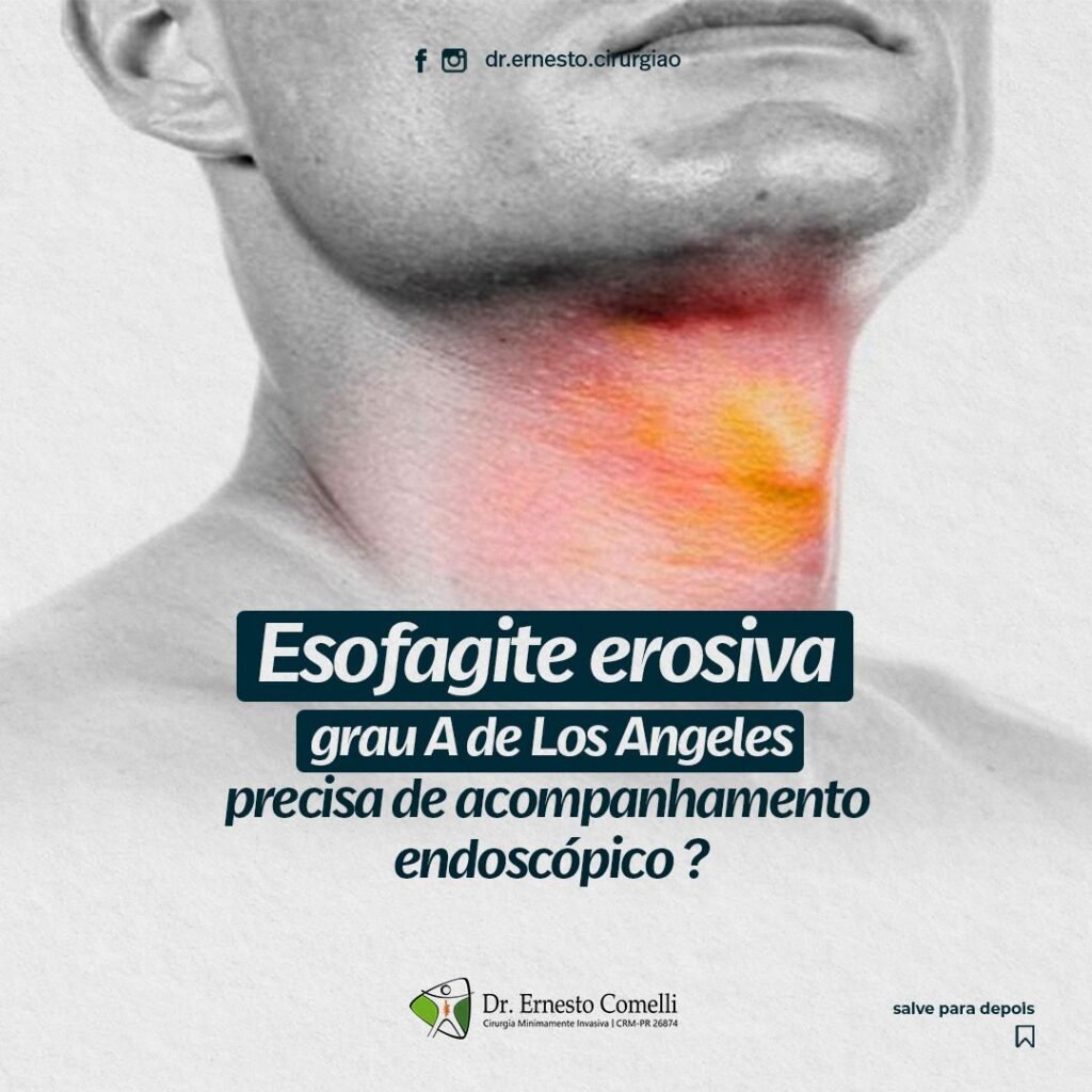 Dr Ernesto Comelli Cirurgia Minimamente Invasiva