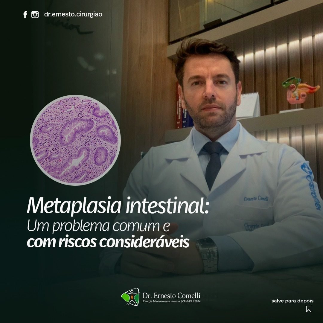 metaplasia intestinal