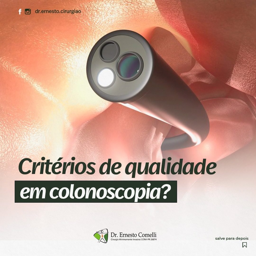 Critérios de qualidade em colonoscopia