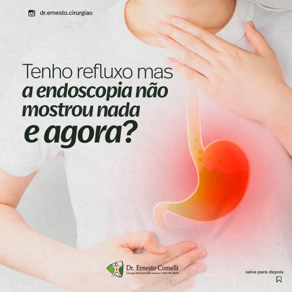 refluxo endoscopia